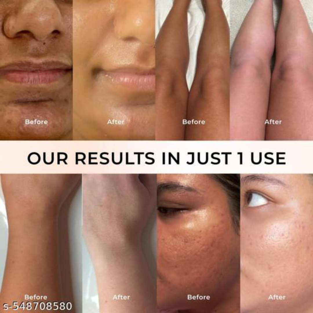 Gluta-Kojic Skin Polish For Detanning & Whitening Skin