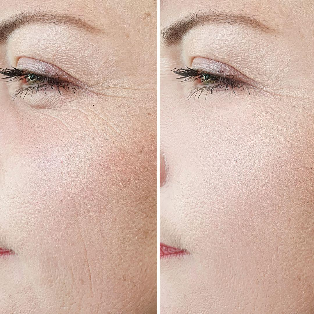 Bakuchiol Plumping Serum - Reduce Scars & Minimize Pores + Provide Even & brighten Skin
