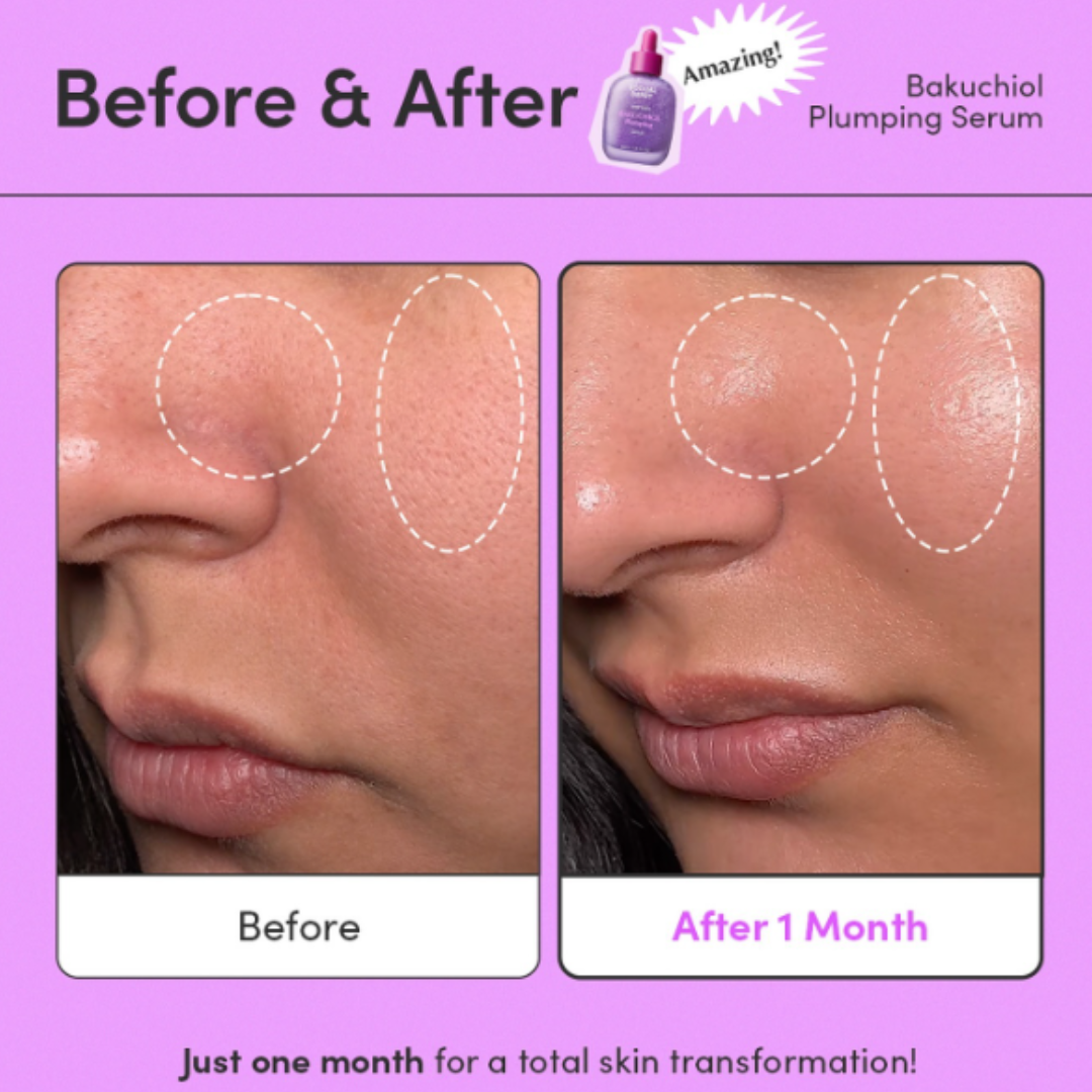 Bakuchiol Plumping Serum - Reduce Scars & Minimize Pores + Provide Even & brighten Skin