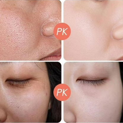 Dr. Melaxin Peel Shot Exfoliating Black Rice Ampoule | Gommage Peeling with Rice Water, Niacinamide & AHA/BHA | Removes Blackheads, Unclogs Pores & Smooths Skin