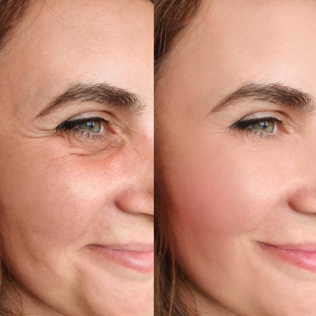 numbuzin No.9+ NAD+ BIO Time Reversing Lifting Essence | Firms, Lifts, Smooths Wrinkles & Restores Glow