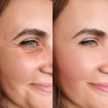 numbuzin No.9+ NAD+ BIO Time Reversing Lifting Essence | Firms, Lifts, Smooths Wrinkles & Restores Glow