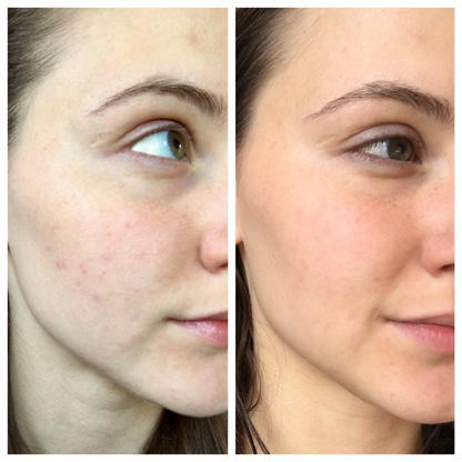 Muse Labs 7% Glycolic Acid Toner | Exfoliating Solution with 5D Hyaluronic Acid & Peptides | Smooth, Bright & Hydrated Skin