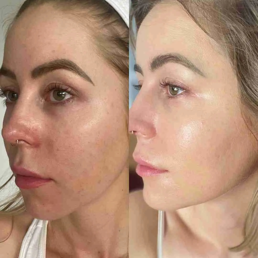 Aroma Magic Skin Glow Facial Kit | 7-in-1 Radiant Glow, Evens Skin Tone & Fades Dark Circles