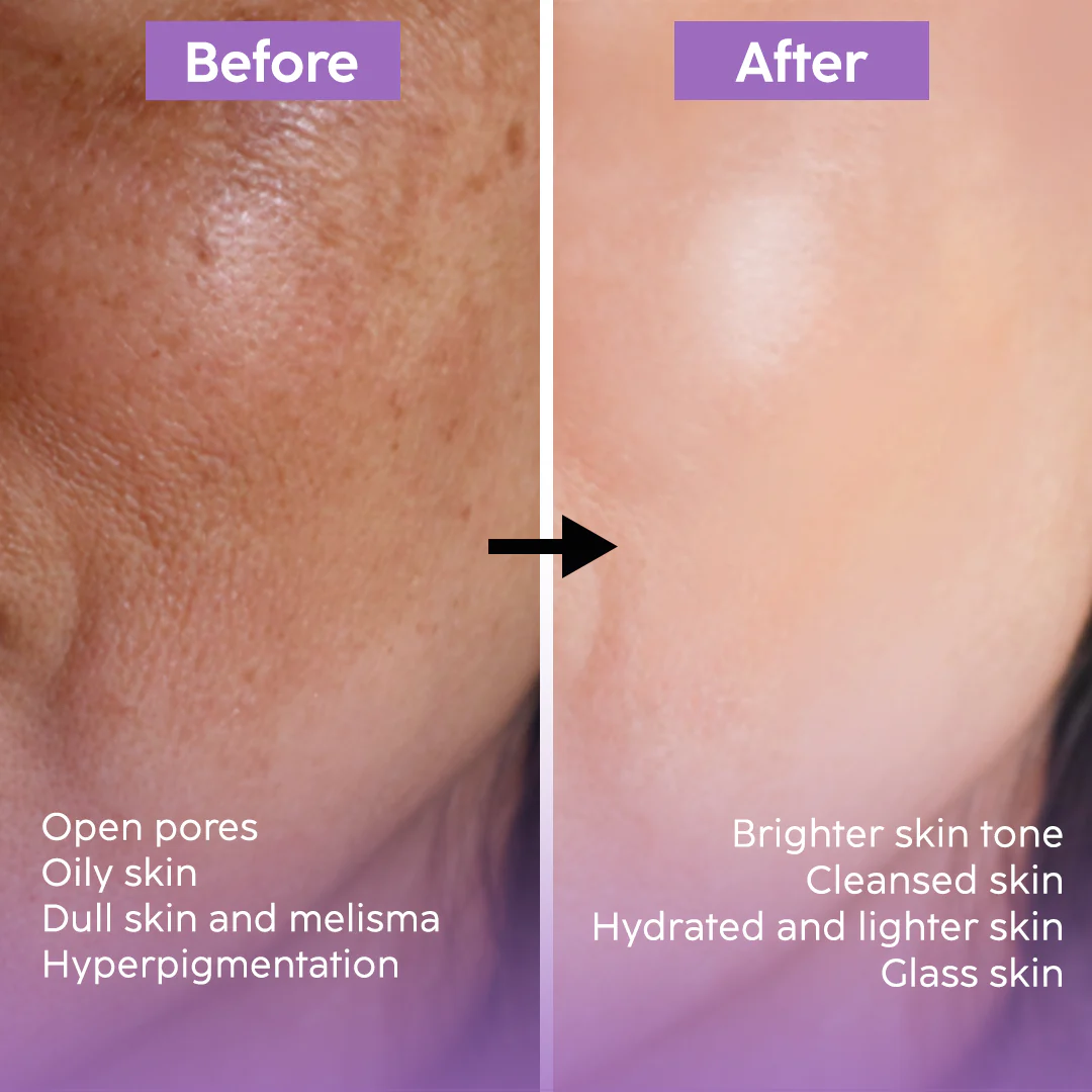 Aroma Magic 7-Step Bridal Glow Facial Kit | Instant Radiance, Skin Brightening & Deep Hydration