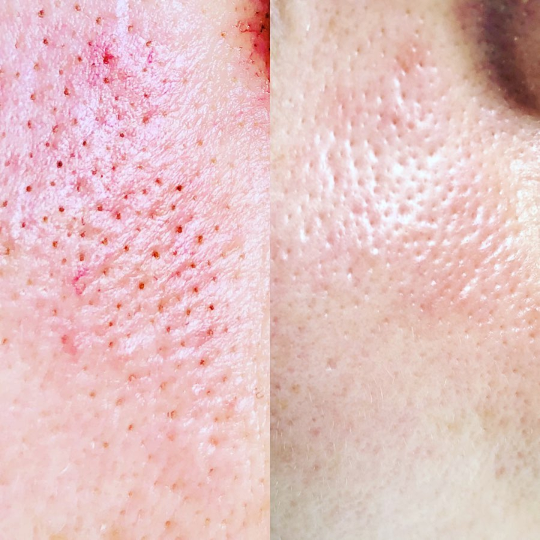 Arencia Fresh Green Rice Mochi Cleanser – Korean Viral Pore Minimizing & Hydrating Daily Face Wash