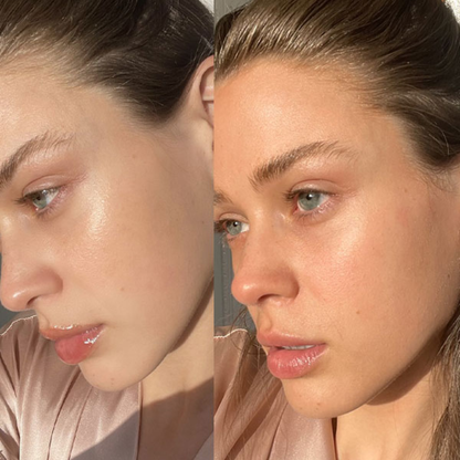 Aroma Magic Skin Glow Facial Kit | 7-in-1 Radiant Glow, Evens Skin Tone & Fades Dark Circles