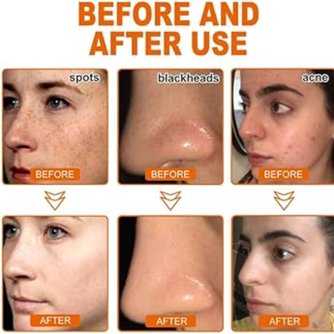 Glamveda Rice & Ceramide Glass Skin Peel-Off Mask – Brightening & Barrier Repair Mask