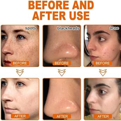 Glamveda Rice & Ceramide Glass Skin Peel-Off Mask – Brightening & Barrier Repair Mask