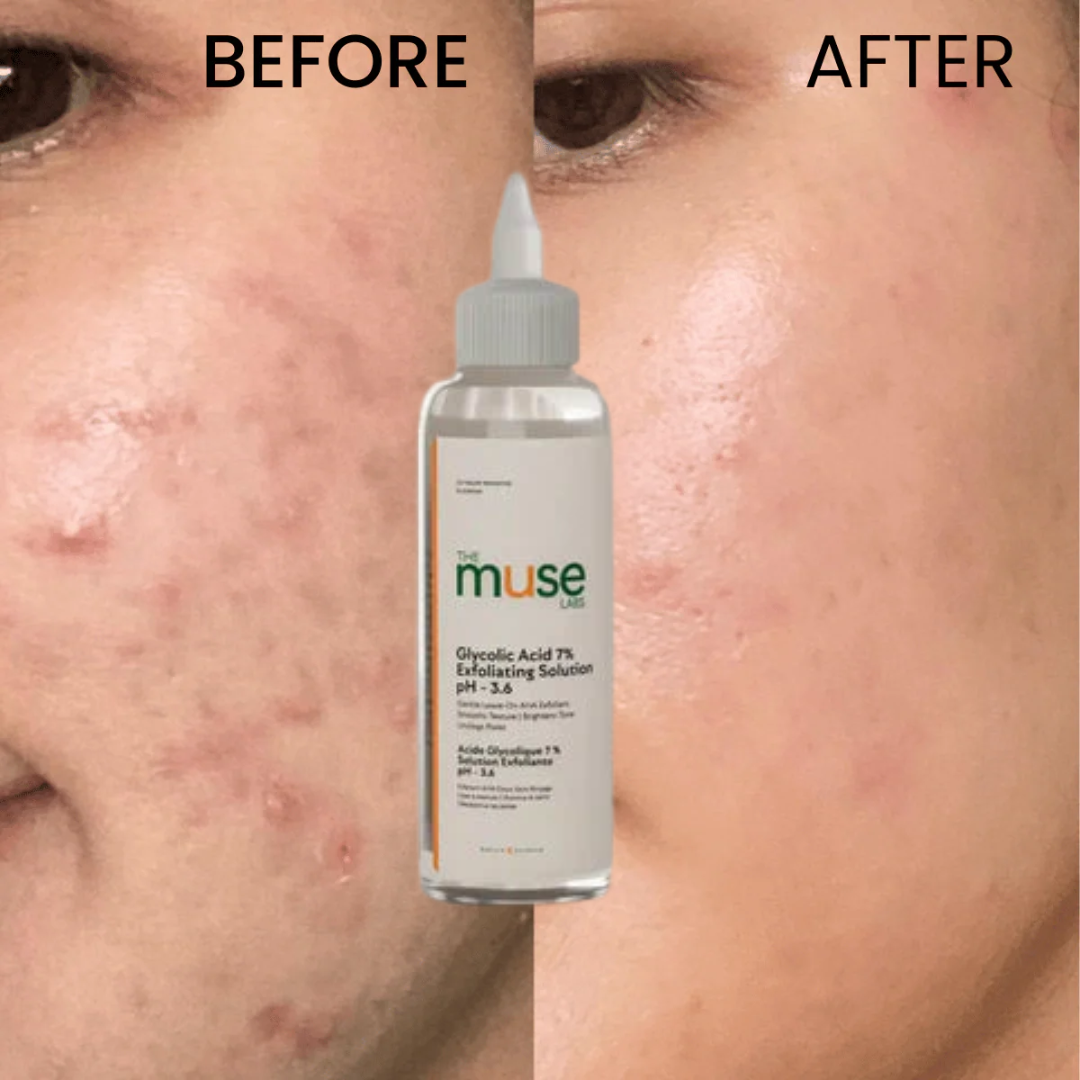 Muse Labs 7% Glycolic Acid Toner | Exfoliating Solution with 5D Hyaluronic Acid & Peptides | Smooth, Bright & Hydrated Skin