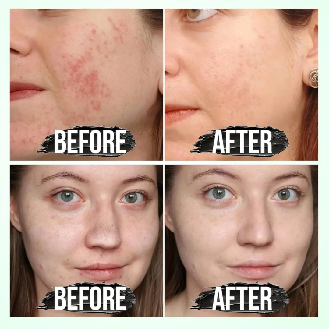 Glamveda Rice & Ceramide Glass Skin Peel-Off Mask – Brightening & Barrier Repair Mask