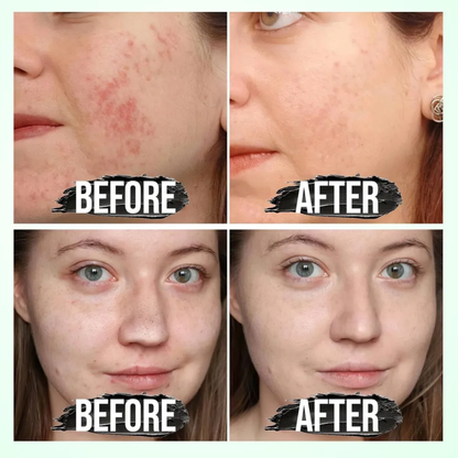 Glamveda Rice & Ceramide Glass Skin Peel-Off Mask – Brightening & Barrier Repair Mask