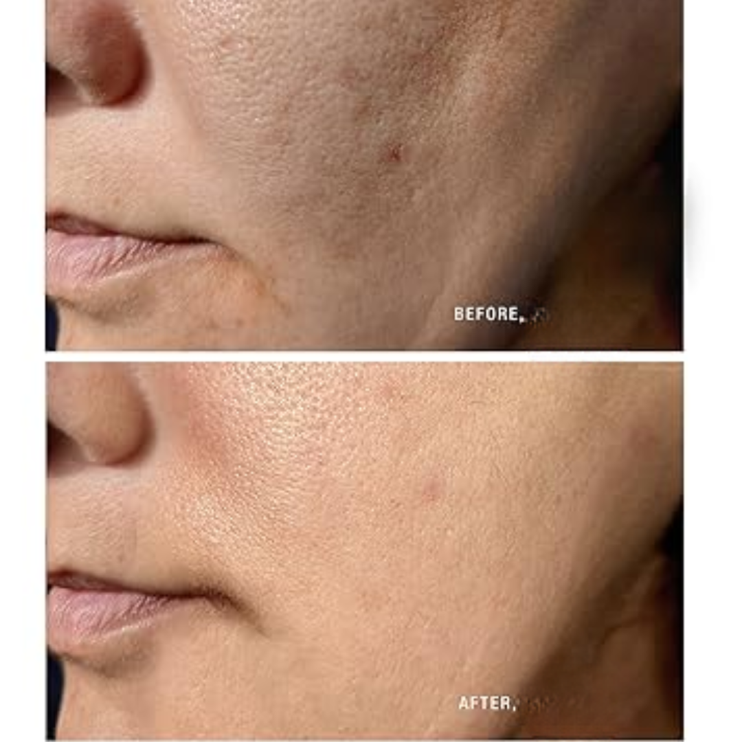 Arencia Fresh Green Rice Mochi Cleanser – Korean Viral Pore Minimizing & Hydrating Daily Face Wash