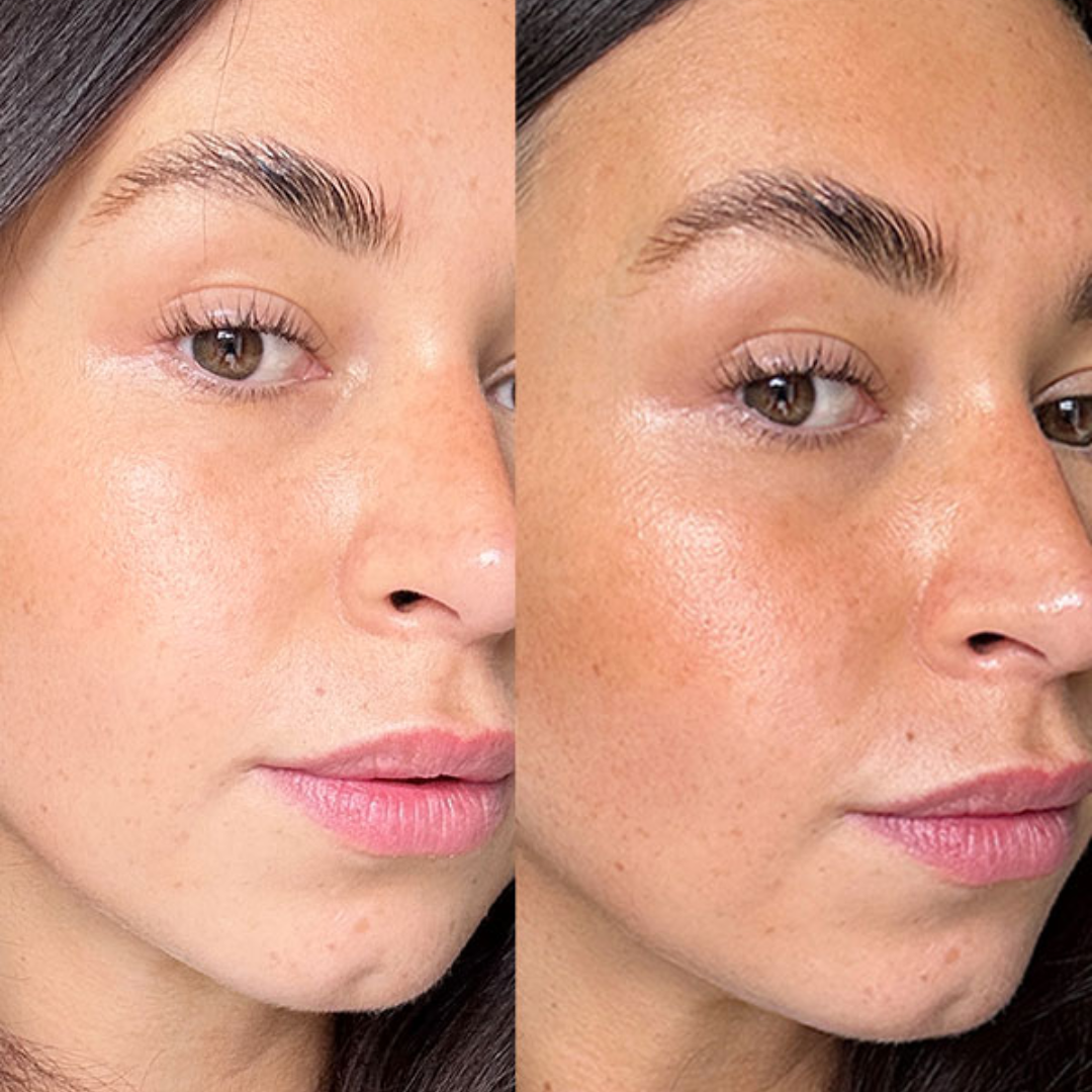 Aroma Magic Skin Glow Facial Kit | 7-in-1 Radiant Glow, Evens Skin Tone & Fades Dark Circles