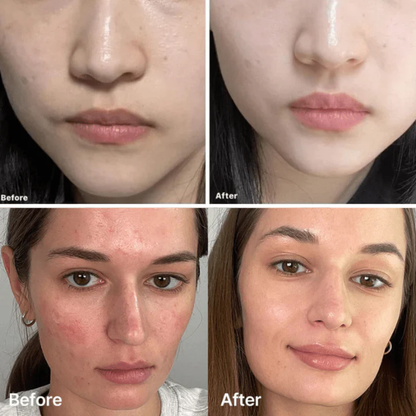 Medicube Deep Vita C Capsule Cream | Customizable Brightening & Hydration Cream for Dark Spots & Dullness
