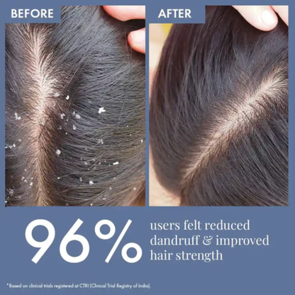 BBlunt Intense Moisture Lamellar Treatment Water | 8-Second In-Shower Hair Transformation with Jojoba & Vitamin E | Frizz Control, Deep Hydration & Shine