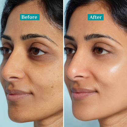 Pilgrim Squalane Glow Moisturizer with Niacinamide & Vitamin C for Brightening & 72HR Hydration