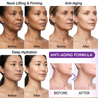 Rozino Neck Firming Lifting Cream | Collagen + Hyaluronic Acid + Vitamin C | Tightens Sagging Neck Skin, Reduces Wrinkles & Restores Elasticity