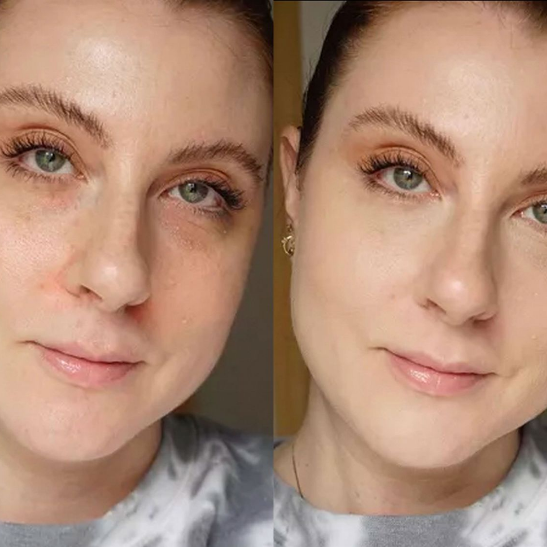 Aroma Magic Skin Glow Facial Kit | 7-in-1 Radiant Glow, Evens Skin Tone & Fades Dark Circles