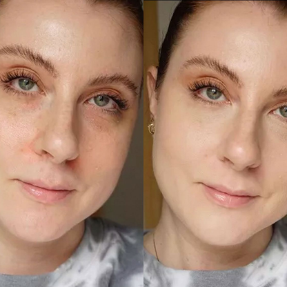 Aroma Magic Skin Glow Facial Kit | 7-in-1 Radiant Glow, Evens Skin Tone & Fades Dark Circles