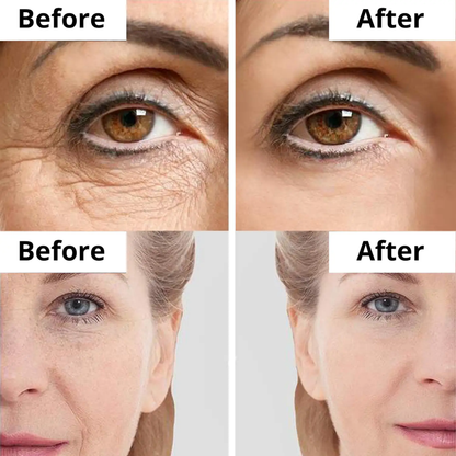 numbuzin No.9+ NAD+ BIO Time Reversing Lifting Essence | Firms, Lifts, Smooths Wrinkles & Restores Glow