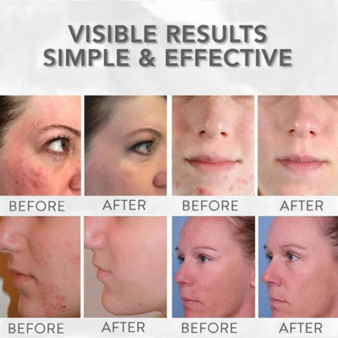 numbuzin No.9+ NAD+ BIO Time Reversing Lifting Essence | Firms, Lifts, Smooths Wrinkles & Restores Glow