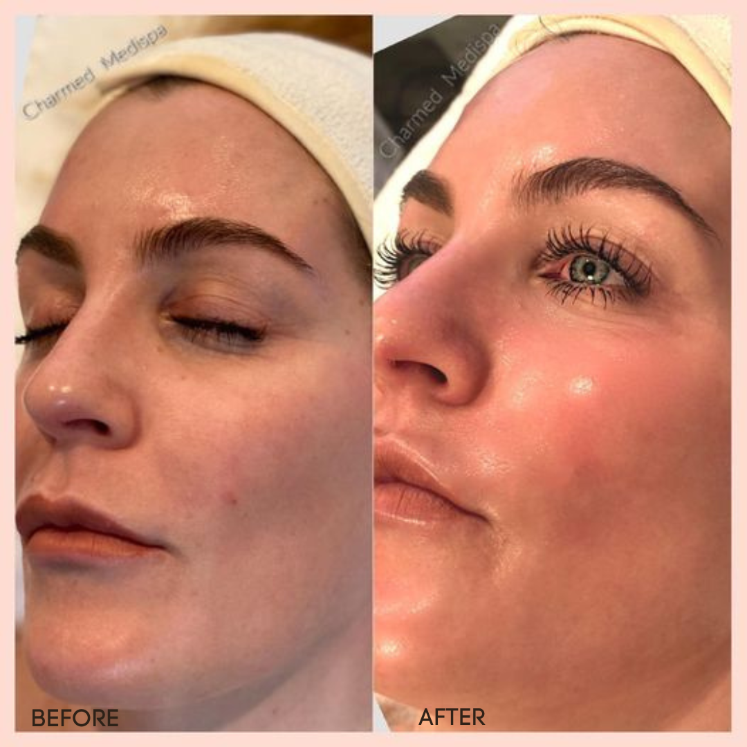 Aroma Magic 7-Step Bridal Glow Facial Kit | Instant Radiance, Skin Brightening & Deep Hydration