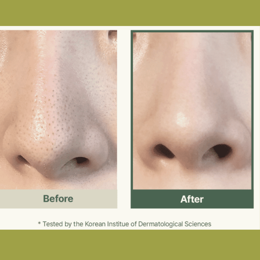 Arencia Fresh Green Rice Mochi Cleanser – Korean Viral Pore Minimizing & Hydrating Daily Face Wash