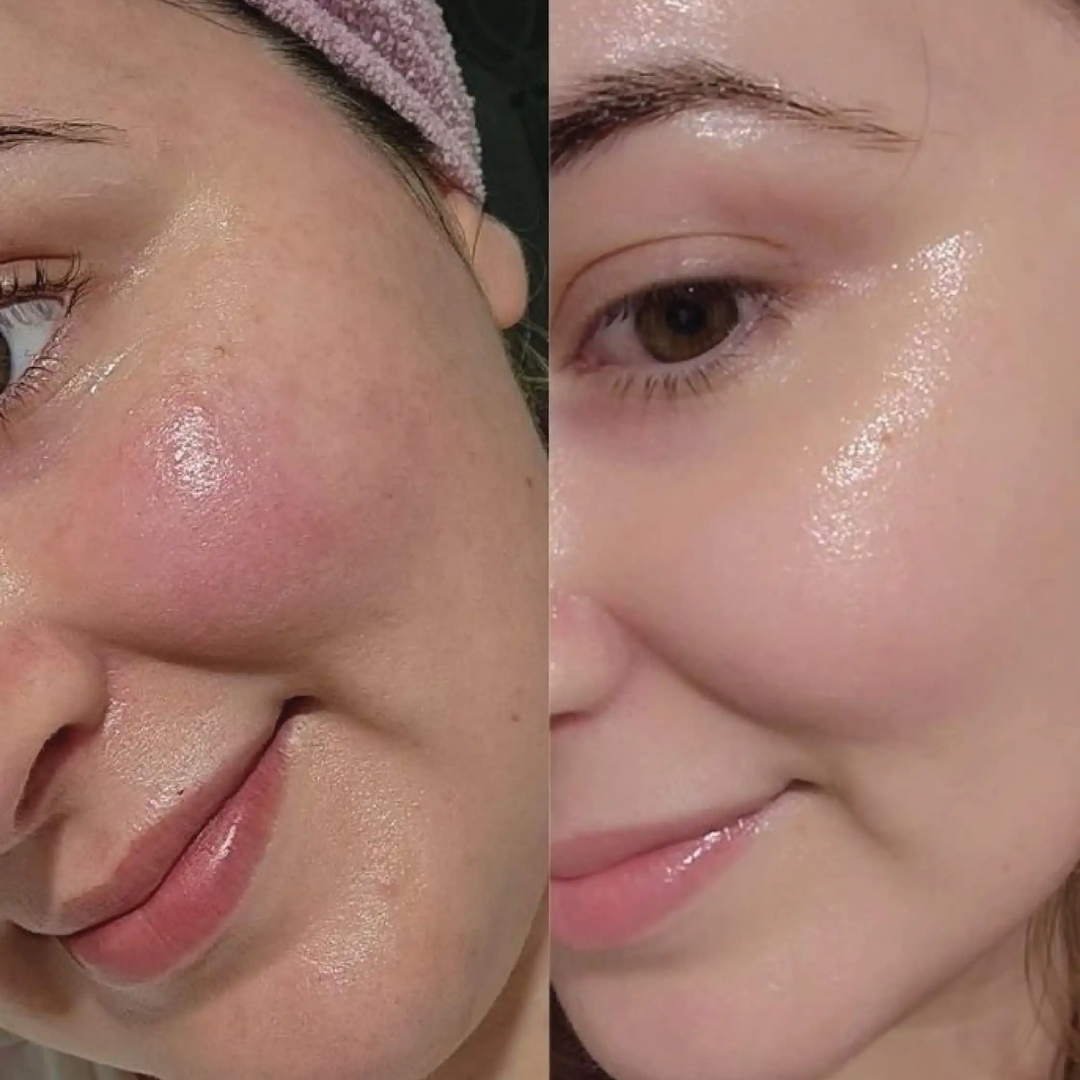 Aroma Magic Skin Glow Facial Kit | 7-in-1 Radiant Glow, Evens Skin Tone & Fades Dark Circles