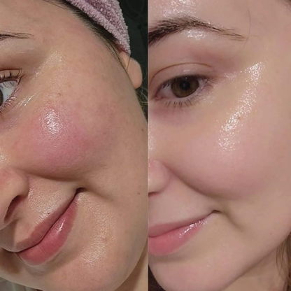 Aroma Magic Skin Glow Facial Kit | 7-in-1 Radiant Glow, Evens Skin Tone & Fades Dark Circles